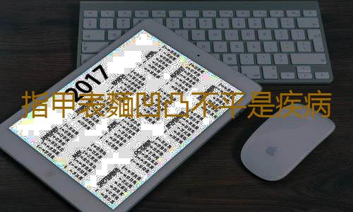 指甲表麵凹凸不平是疾病預兆 指甲形狀與疾病的關係